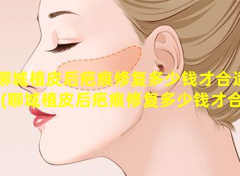 聊城植皮后疤痕修复多少钱才合适(聊城植皮后疤痕修复多少钱才合 💮 适 🦟 啊)